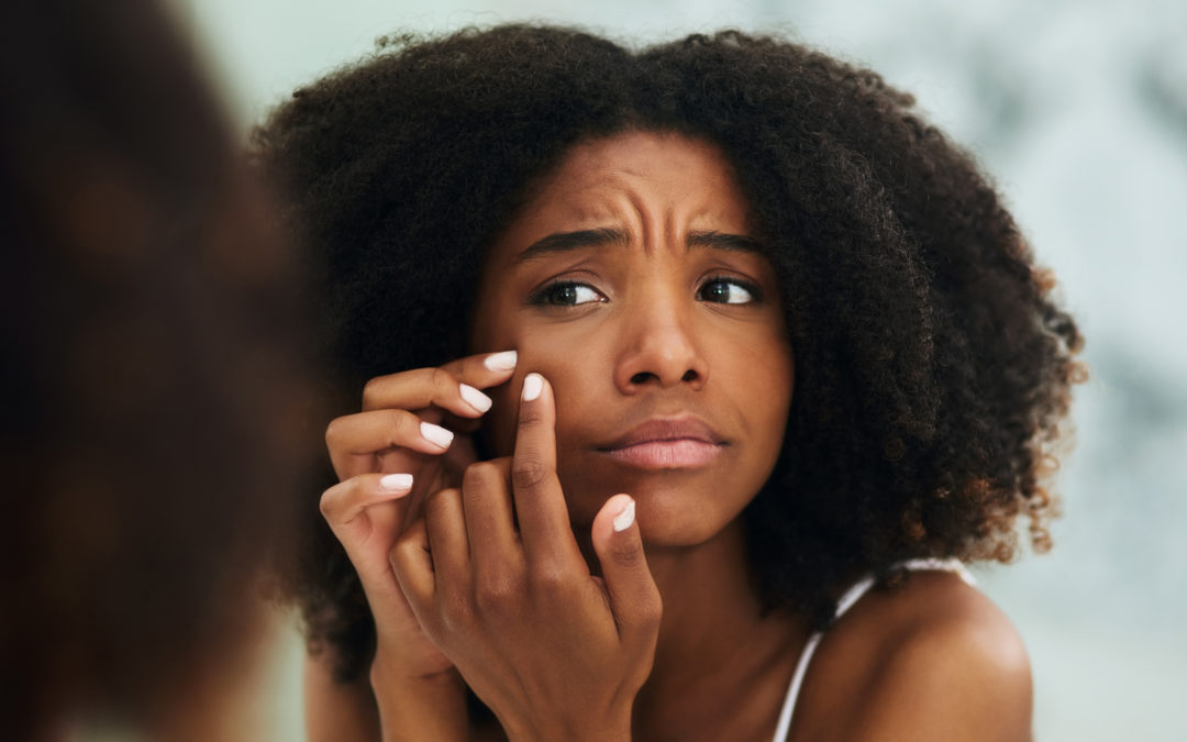 early wrinkles on black women skin